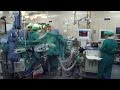 ver trabalho Autotransplante de Fígado - CHUC 2016