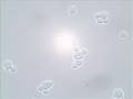 Budding and Shmooing   Yeast Reproduction