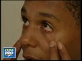 Boy Cries Tears of Blood