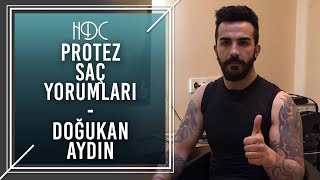 Protez Saç Yorumları - Doğukan Aydın - HDC - H