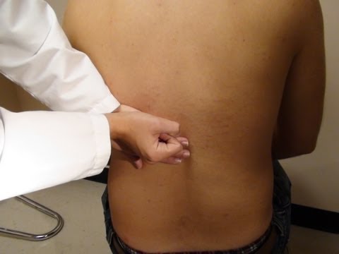 Pyelonephritis - Causes, Clinical ...
