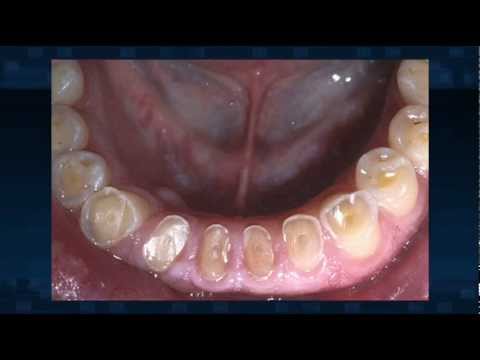 See video