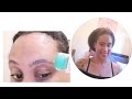 Can Derma Rolling Help Eyebrow Growth