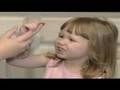 Strep-Throat-in-Kids