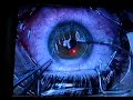LASIK cerrahisi