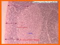 PowerPoint Video: Endocrine System Histology PowerPoint Video: Endocrine System Histology