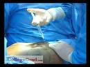 Surgical Technologists Surgical Technologists