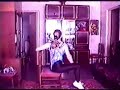 amputee lena 1