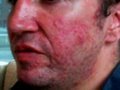 The Acne Practice  (Home Version 13)