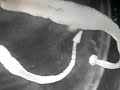 Tapeworms from a Sand shiner minnow