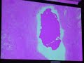 Prostate Gland Prostate Gland