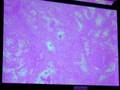 Prostate Gland