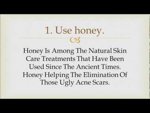 how to naturally get rid of acne scars