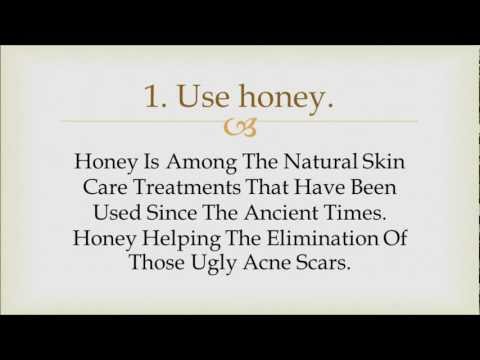 how to remove acne scars naturally