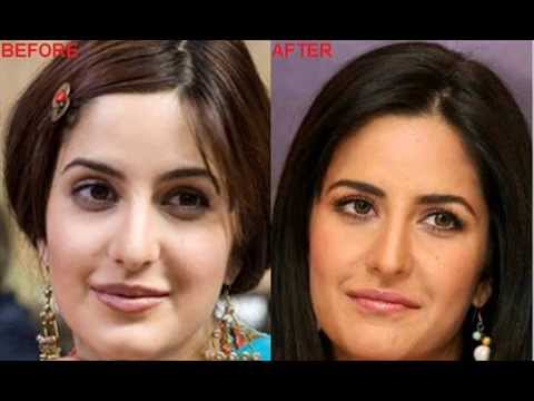 Gauri Khan Plastic Surgery on Bollywood Stars Plastic Surgery