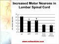 Stem cell therapy for ALS