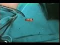 UEPB - CIRURGIA DE DENTE INCLUSO - ADULTO UEPB - CIRURGIA DE DENTE INCLUSO - ADULTO