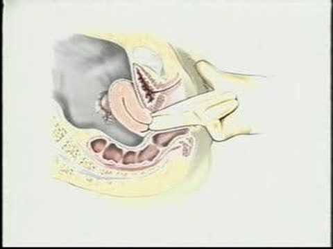 university video pelvic exam