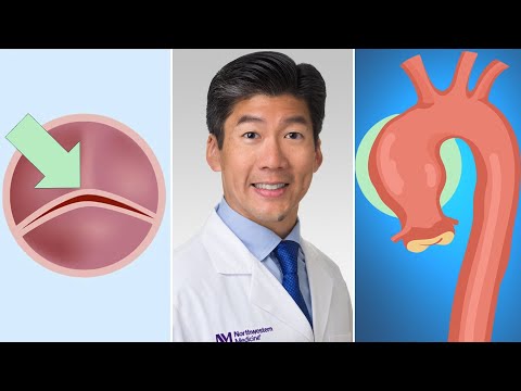 Surgeon Q&A: Bicuspid Aortic Valves, Connective Tissue Disorders & Aneurysms