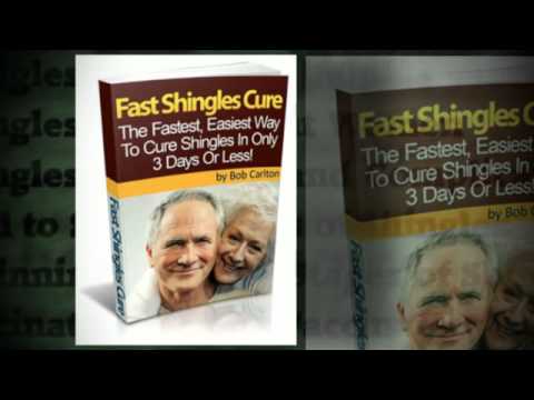 how to treat shingles