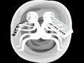 aphex twin - melodies from mars - 03 - untitled aphex twin - melodies from mars - 03 - untitled