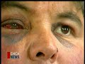 Allegations Against 6N Police