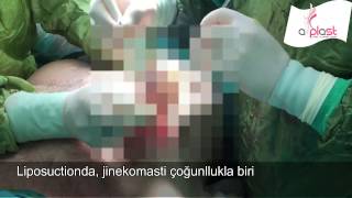 Gökhan Özerdem-59