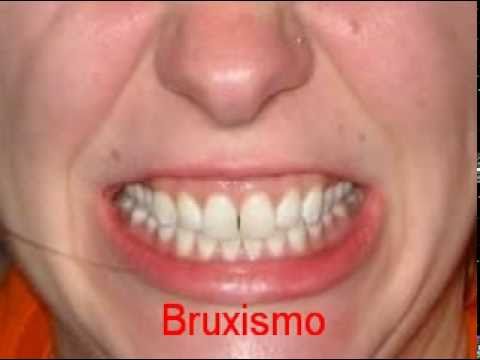 componentes de la sangre, componentes de la sangre,