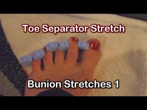 how to relieve bunion pain