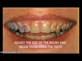 How To Whiten Teeth With Pic Monkey