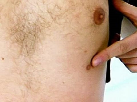 Embarrassing Illnesses | Third Nipple | Channel 4. Luke visits the doctor with a problem he wants to get off his chest | Watch Embarrassing Illnesses 