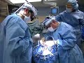 clival-chordoma-rare-tumour-brain-surgery.html