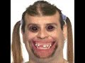 Resident Evil 4 Mercenaries - Benny Hill Resident Evil 4 Mercenaries - Benny Hill