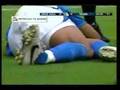 videos de la peor lesion del futbol mexicano
