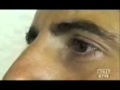 Capgras' delusion patient