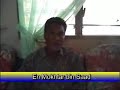 testimoni bengkak payudara