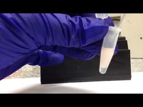 how to isolate exosomes from blood