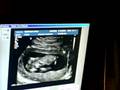 Blueberry's Ultrasound Video 1 (July 23, 2008)