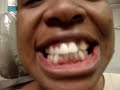 121-1 Dr. Daniel Noor, DMD - Invisalign Expert -Dental Pride