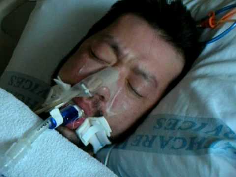 In A Coma After Alcohol Withdrawal