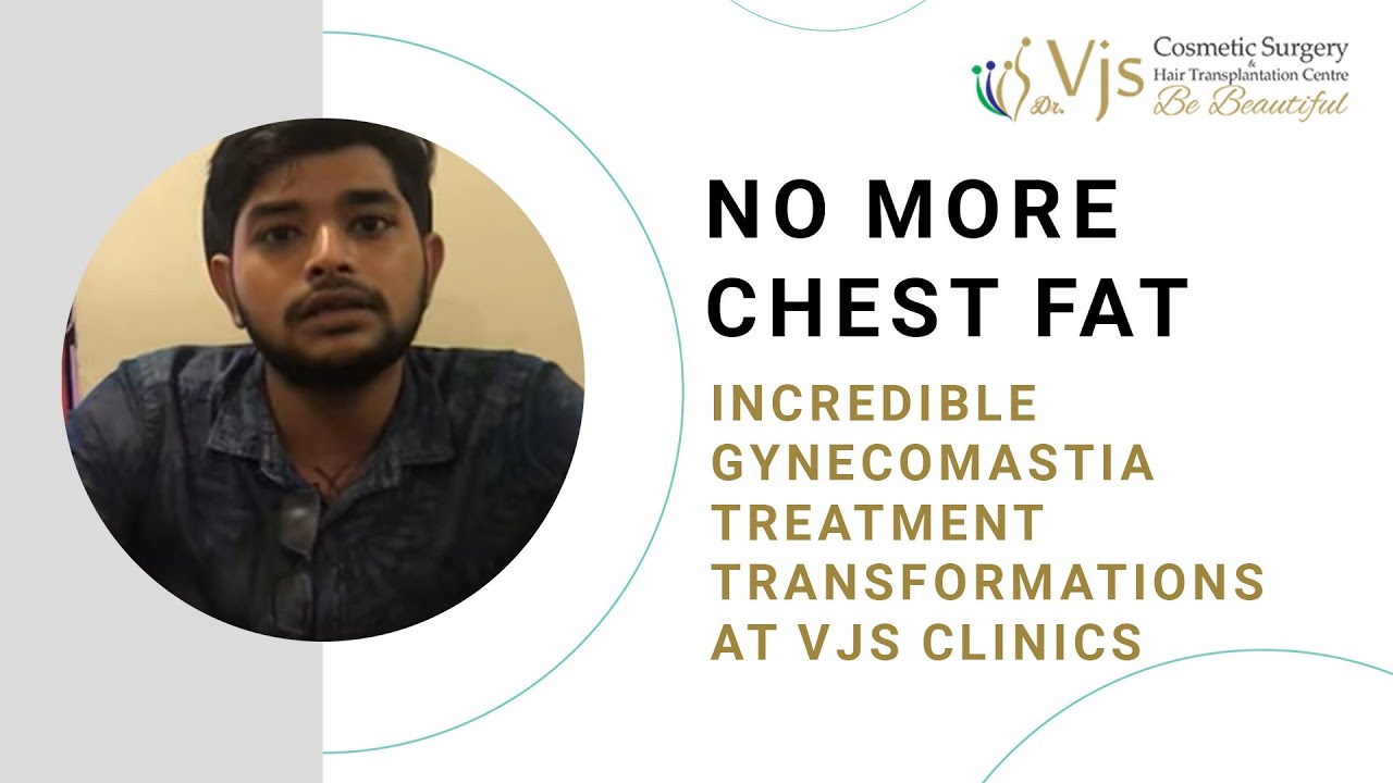Patient Testimonial | Gynecomastia Treatment | Vjs Clinics