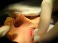 CIRURGIA MAXILO FACIAL Dr MARTINS Dr SARAIVA