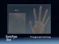The GenoType Diet: Determining Fingerprint Patterns The GenoType Diet: Determining Fingerprint Patterns