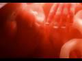 A SIN done to our children ( Autism ) - YouTube