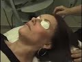 Photo Facial