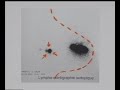 Sentinel Lymph Node removal in breast Cancer
