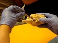 Professor Narrated: The Infundibulum of the Brain  Anatomy Endocrine System