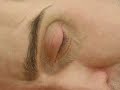 Ron Mueck e l\ Ron Mueck e l\