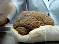 olha ae galera p vc estudarem hehe ... aula de neurologia 2 parte