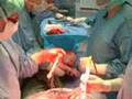 My Cesarean Delivery To My Baby William